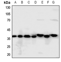 1 - Anti-Annexin A2 Antibody AP50977