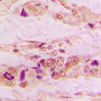 19 - Anti-Annexin A3 Antibody AP50978