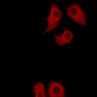 3 - Anti-Annexin A6 Antibody AP50979