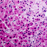 19 - Anti-Annexin A6 Antibody AP50979