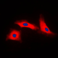 3 - Anti-APAF-1-ALT Antibody AP50980