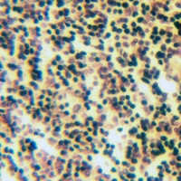 19 - Anti-Apolipoprotein F Antibody AP50987
