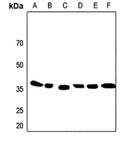 1 - Anti-Apolipoprotein F Antibody AP50987