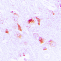 19 - Anti-Apolipoprotein L2 Antibody AP50988
