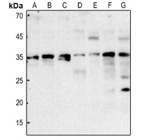 1 - Anti-Aquaporin 12A Antibody AP50989
