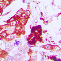 19 - Anti-Aquaporin 3 Antibody AP50990