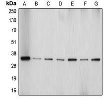 1 - Anti-Aquaporin 4 Antibody AP50991