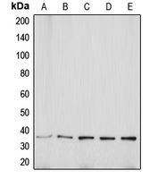 1 - Anti-Aquaporin 5 Antibody AP50992
