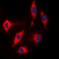 3 - Anti-ARHGAP17 Antibody AP50993