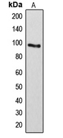 1 - Anti-ARHGAP17 Antibody AP50993
