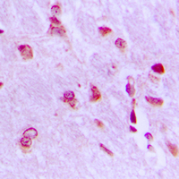 19 - Anti-ARHGAP18 Antibody AP50994