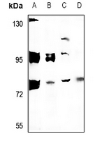 1 - Anti-ARHGAP18 Antibody AP50994