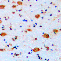 19 - Anti-ARHGAP22 Antibody AP50995