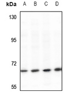 1 - Anti-ARHGAP22 Antibody AP50995