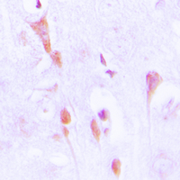 19 - Anti-Beta-arrestin-1 (Phospho-S412) Antibody AP50996