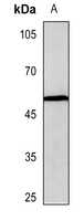 1 - Anti-Beta-arrestin-1 (Phospho-S412) Antibody AP50996