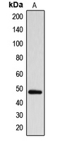 1 - Anti-ARRDC1 Antibody AP50997