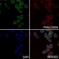 3 - Anti-Arylsulfatase A Antibody AP50998