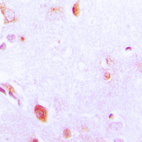 19 - Anti-Arylsulfatase A Antibody AP50998