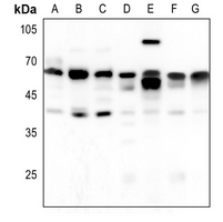 1 - Anti-Arylsulfatase A Antibody AP50998