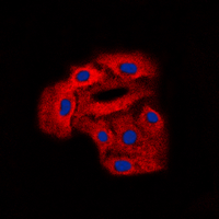 3 - Anti-Arylsulfatase D Antibody AP50999