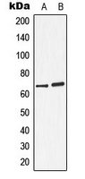 1 - Anti-Arylsulfatase D Antibody AP50999