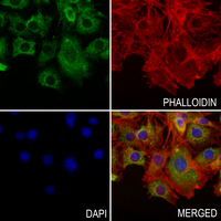 3 - Anti-Arylsulfatase E Antibody AP51000