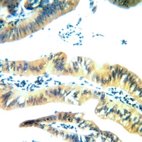 19 - Anti-Arylsulfatase E Antibody AP51000