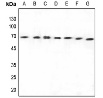 1 - Anti-Arylsulfatase E Antibody AP51000