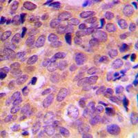 19 - Anti-ATF4 Antibody AP51001