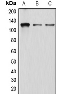 1 - Anti-Atrophin-1 Antibody AP51002