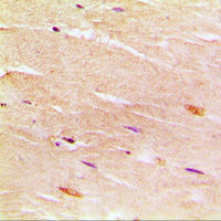 19 - Anti-SERCA1 Antibody AP51003