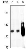 1 - Anti-SERCA1 Antibody AP51003
