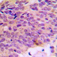 19 - Anti-ATP5A1 Antibody AP51004
