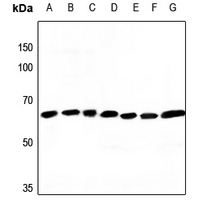1 - Anti-ATP5A1 Antibody AP51004