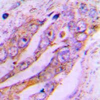 19 - Anti-ATP5JL Antibody AP51005