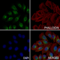 3 - Anti-Ataxin 2 Antibody AP51006