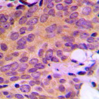 19 - Anti-Ataxin 2 Antibody AP51006