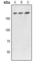 1 - Anti-Ataxin 2 Antibody AP51006