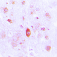 19 - Anti-NAP1 Antibody AP51007
