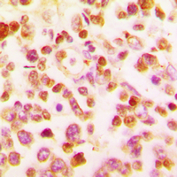 19 - Anti-BCL6 Antibody AP51011