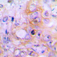 19 - Anti-BMP2 Antibody AP51012