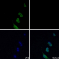 3 - Anti-BMP5 Antibody AP51013