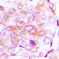 19 - Anti-BMP5 Antibody AP51013