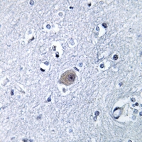19 - Anti-BMP8A Antibody AP51014