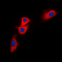 3 - Anti-BNIP2 Antibody AP51015