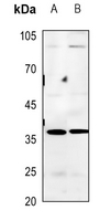 1 - Anti-BNIP2 Antibody AP51015