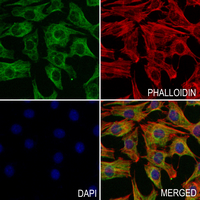3 - Anti-BNIP2 Antibody AP51016