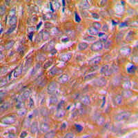 19 - Anti-BNIP2 Antibody AP51016