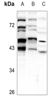 1 - Anti-BNIP2 Antibody AP51016